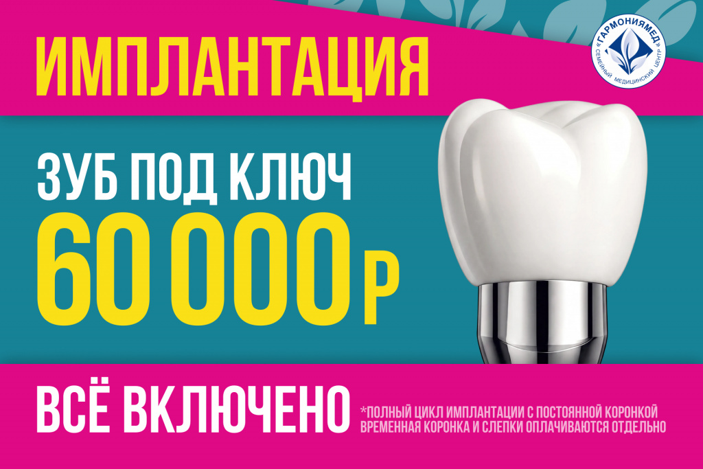 Имплантация зубов - Стоматология Гармония Мед